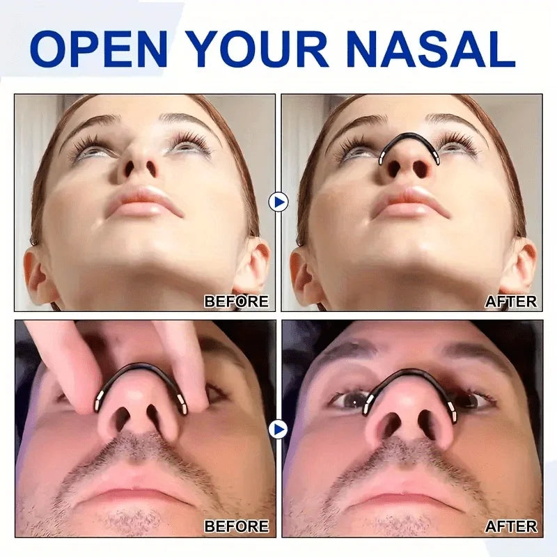 Sport Nasal Dilator Sleep Nasal Breathing Dilators Starter Kit Nose Breathe Strips Magnetic Nasal Strips Reduce Snoring